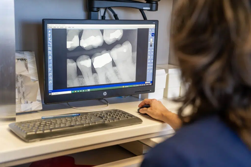 dental screening