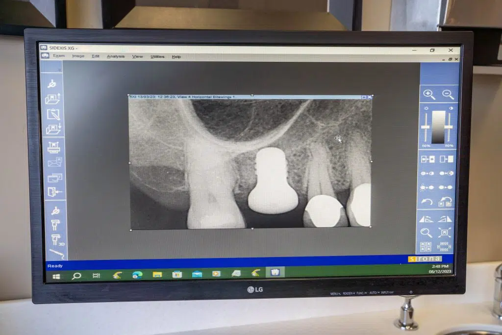 dental screening