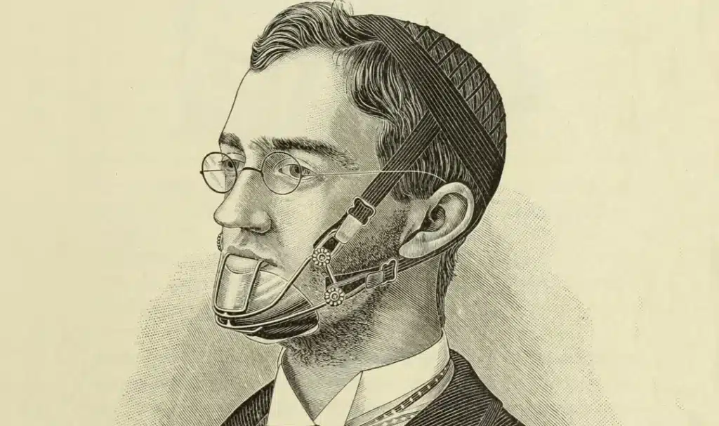 When Were Orthodontic Braces Invented? Shocking Truth You Should Know