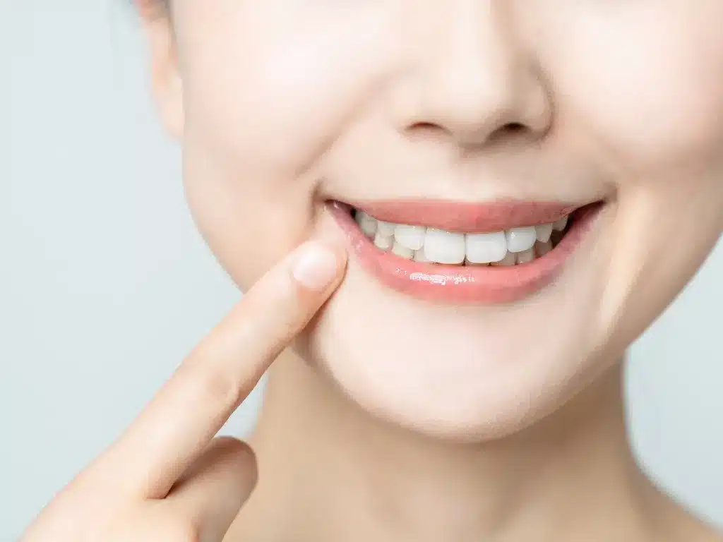 How Long Do Dental Bonds Last